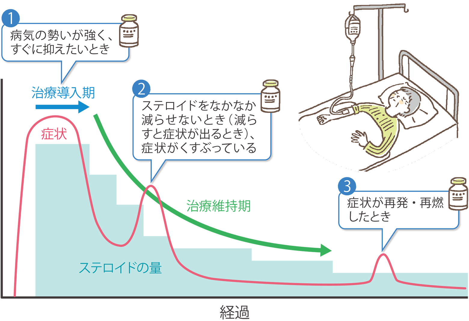 治療のイメージ図