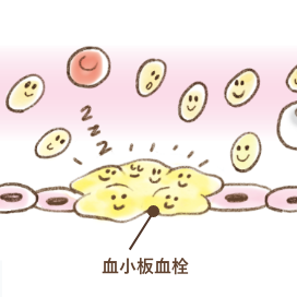 血が止まる仕組み：血小板血栓ができ一次止血